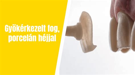 A héj felszerelése
