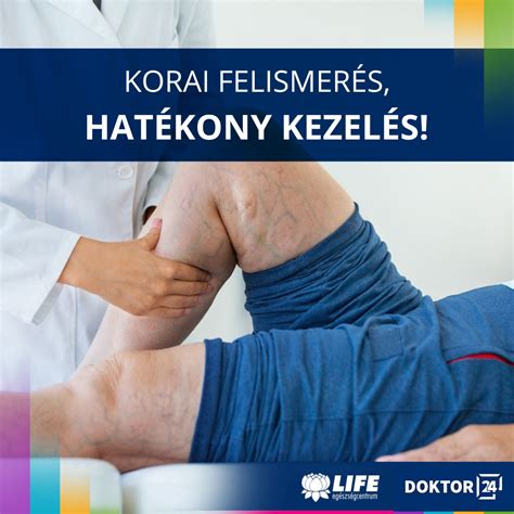 Az ólomakkumulátor kapacitásának csökkenése az évek során