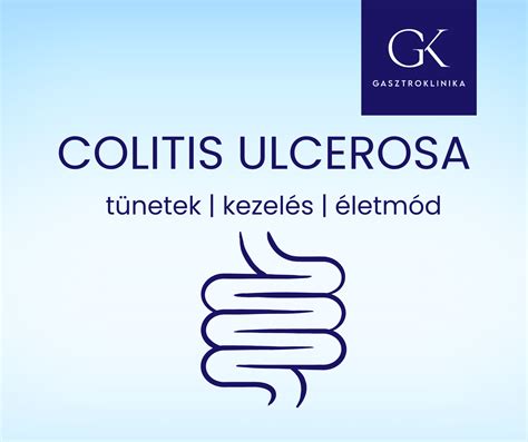 Colitis Ulcerosa Tünetei