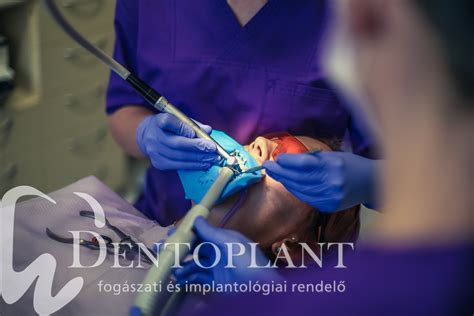 Fogászati kezelések infografika