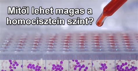 Hűtővíz túl magas hőmérséklete