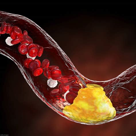 Olajkoksz-lerakódás