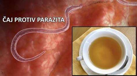 Parazita nyomatékok