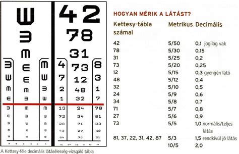 Szemészeti vizsgálat