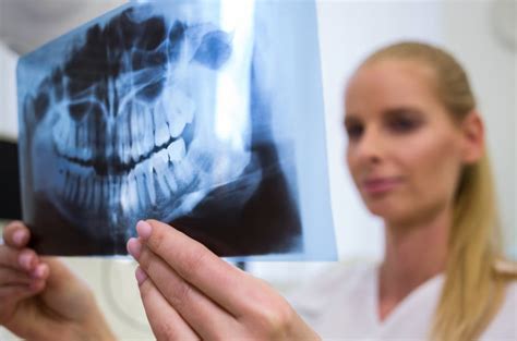 Szenzor röntgenképe