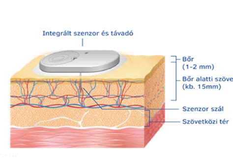 Tolatóradar szenzorok elhelyezése