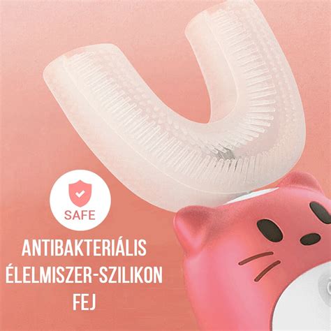 U alakú lapkák eltávolítása